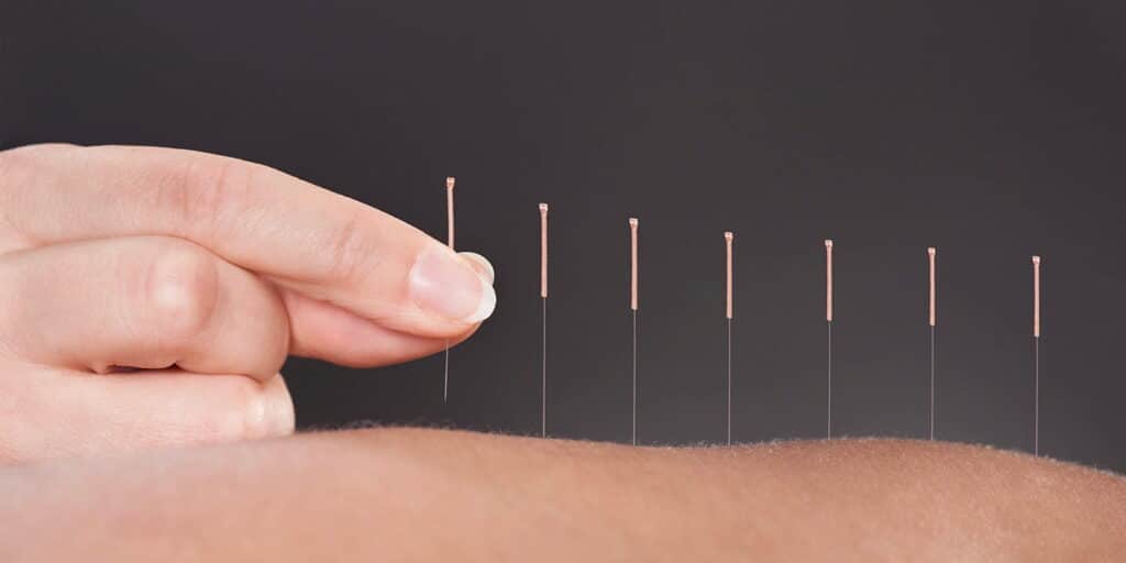 Acupuncture Job Details Cruise Liner London Wellness Academy