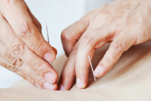 Apply for acupuncture jobs